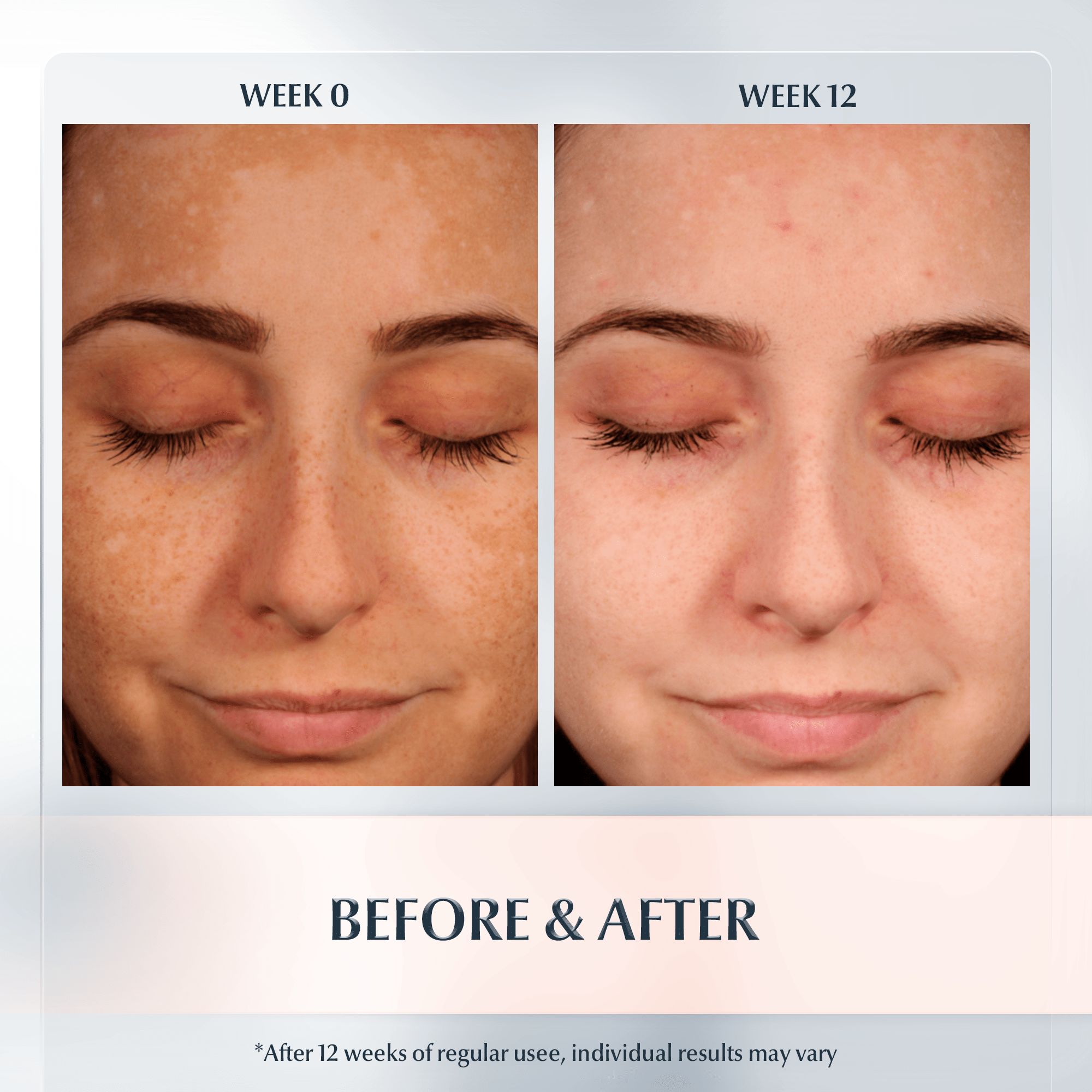 Anti Pigment Spot Corrector For All Skin Types Topical Dark Spot anti-pigment-spot-corrector-for-all-skin-types-topical-dark-spot